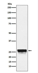 Anti-CTRL Rabbit Monoclonal Antibody Boster Bio