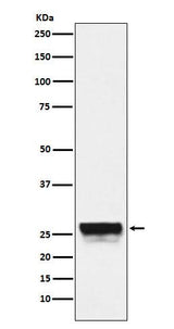 Anti-CTRL Rabbit Monoclonal Antibody Boster Bio