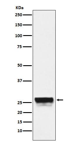 Anti-CTRL Rabbit Monoclonal Antibody Boster Bio