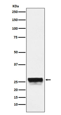 Anti-CTRL Rabbit Monoclonal Antibody Boster Bio