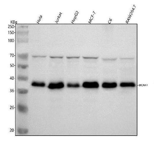 Anti-DCAF7 Rabbit Monoclonal Antibody Boster Bio