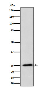 Anti-RPL10A Rabbit Monoclonal Antibody Boster Bio