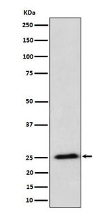 Anti-RPL10A Rabbit Monoclonal Antibody Boster Bio