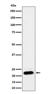 Anti-NDUFB9 Rabbit Monoclonal Antibody Boster Bio