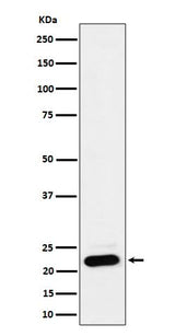 Anti-NDUFB9 Rabbit Monoclonal Antibody Boster Bio