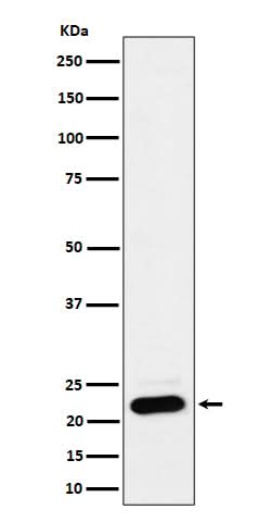 Anti-NDUFB9 Rabbit Monoclonal Antibody Boster Bio