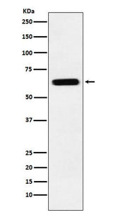 Anti-CRMP5 Rabbit Monoclonal Antibody Boster Bio