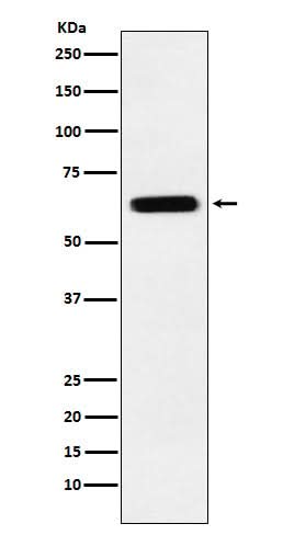 Anti-CRMP5 Rabbit Monoclonal Antibody Boster Bio