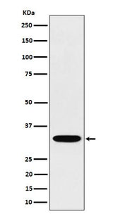 Anti-TSFM Rabbit Monoclonal Antibody Boster Bio