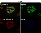 Anti-TOMM22/TOM22 Rabbit Monoclonal Antibody Boster Bio