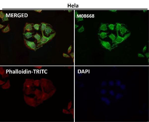 Anti-TOMM22/TOM22 Rabbit Monoclonal Antibody Boster Bio