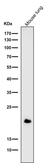 Anti-DNPH1 Rabbit Monoclonal Antibody Boster Bio