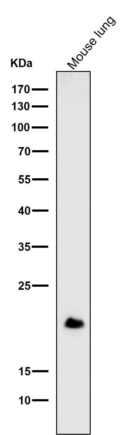 Anti-DNPH1 Rabbit Monoclonal Antibody Boster Bio