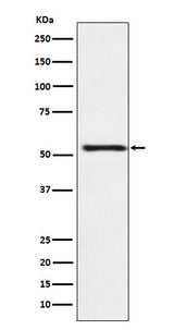 Anti-ATP4B Rabbit Monoclonal Antibody Boster Bio