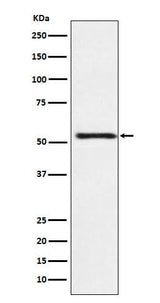Anti-ATP4B Rabbit Monoclonal Antibody Boster Bio