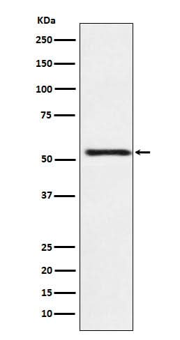 Anti-ATP4B Rabbit Monoclonal Antibody Boster Bio