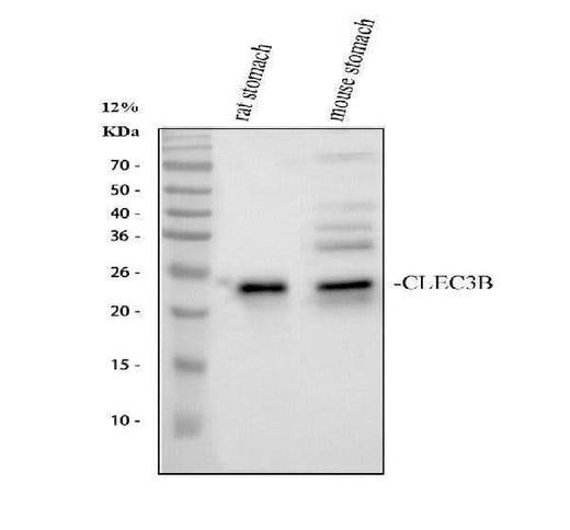 Anti-Tetranectin Rabbit Monoclonal Antibody Boster Bio