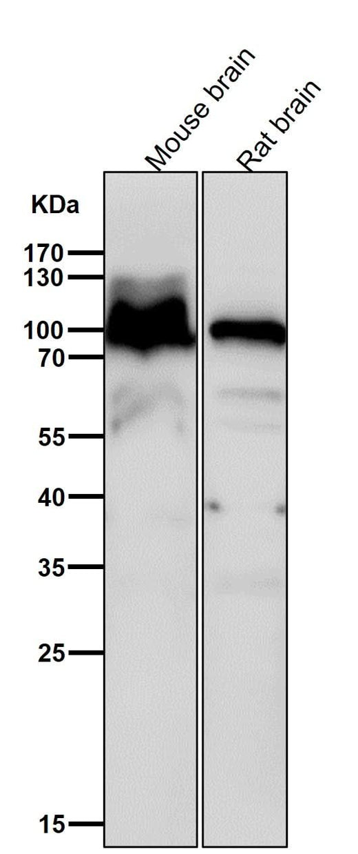 Anti-Alpha1 adaptin AP2A1 Monoclonal Antibody Boster Bio