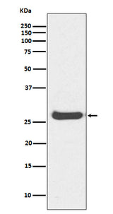 Anti-Histone H1.0 H1F0 Rabbit Monoclonal Antibody Boster Bio