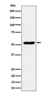 Anti-GPRC5B Rabbit Monoclonal Antibody Boster Bio