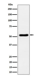 Anti-GPRC5B Rabbit Monoclonal Antibody Boster Bio