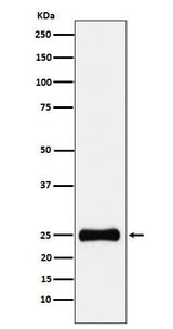 Anti-PSMA2 Rabbit Monoclonal Antibody Boster Bio