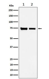 Anti-CPSF73 Rabbit Monoclonal Antibody Boster Bio