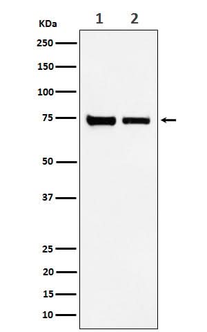 Anti-CPSF73 Rabbit Monoclonal Antibody Boster Bio
