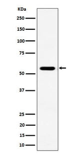 Anti-RNF14 Rabbit Monoclonal Antibody Boster Bio