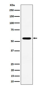 Anti-RNF14 Rabbit Monoclonal Antibody Boster Bio