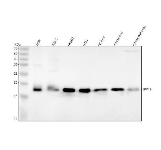 Anti-ERp19 Rabbit Monoclonal Antibody Boster Bio
