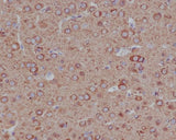 Anti-Tubulin beta 4B/2A/2B Rabbit Monoclonal Antibody Boster Bio
