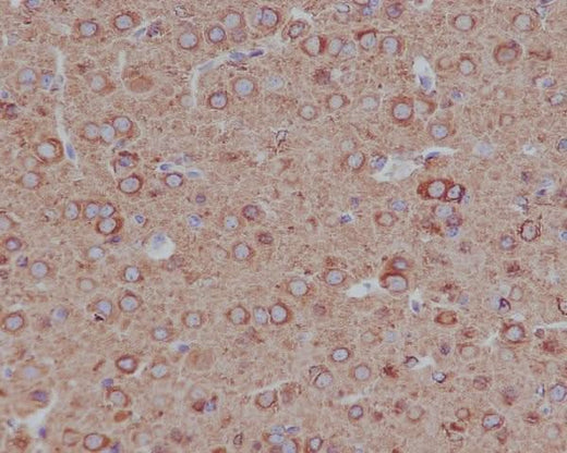 Anti-Tubulin beta 4B/2A/2B Rabbit Monoclonal Antibody Boster Bio