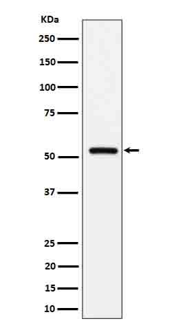 Anti-Fetuin B Rabbit Monoclonal Antibody Boster Bio