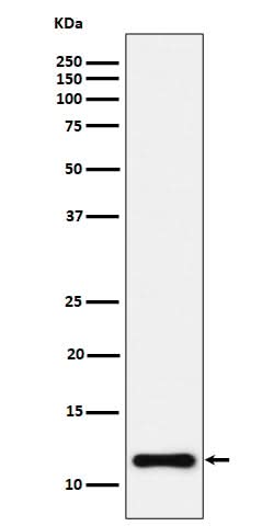 Anti-NDUFC2 Rabbit Monoclonal Antibody Boster Bio