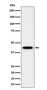 Anti-ITPK1 Rabbit Monoclonal Antibody Boster Bio