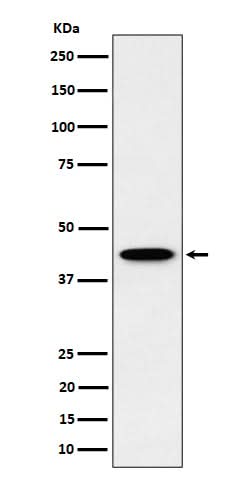 Anti-ITPK1 Rabbit Monoclonal Antibody Boster Bio