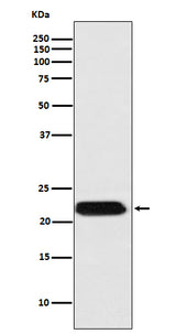 Anti-FTMT Rabbit Monoclonal Antibody Boster Bio
