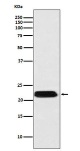 Anti-FTMT Rabbit Monoclonal Antibody Boster Bio