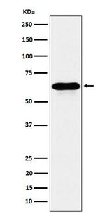 Anti-COASY Rabbit Monoclonal Antibody Boster Bio
