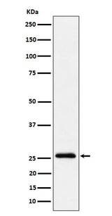 Anti-TEMT Rabbit Monoclonal Antibody Boster Bio