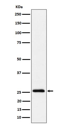 Anti-TEMT Rabbit Monoclonal Antibody Boster Bio