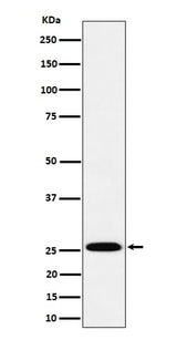 Anti-TEMT Rabbit Monoclonal Antibody Boster Bio