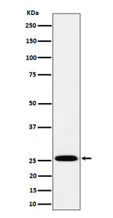 Anti-TEMT Rabbit Monoclonal Antibody Boster Bio