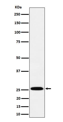 Anti-TEMT Rabbit Monoclonal Antibody Boster Bio