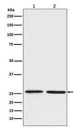 Anti-BNIP1 Rabbit Monoclonal Antibody Boster Bio