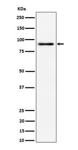 Anti-ACAP2 Rabbit Monoclonal Antibody Boster Bio