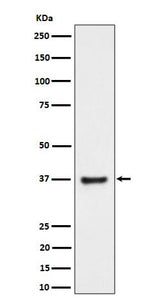Anti-RNF115 Rabbit Monoclonal Antibody Boster Bio