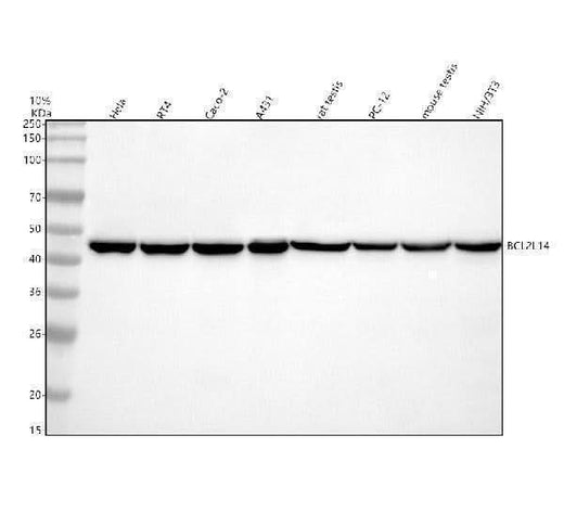 Anti-BCLG Rabbit Monoclonal Antibody Boster Bio