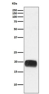 Anti-Mammaglobin A Rabbit Monoclonal Antibody Boster Bio